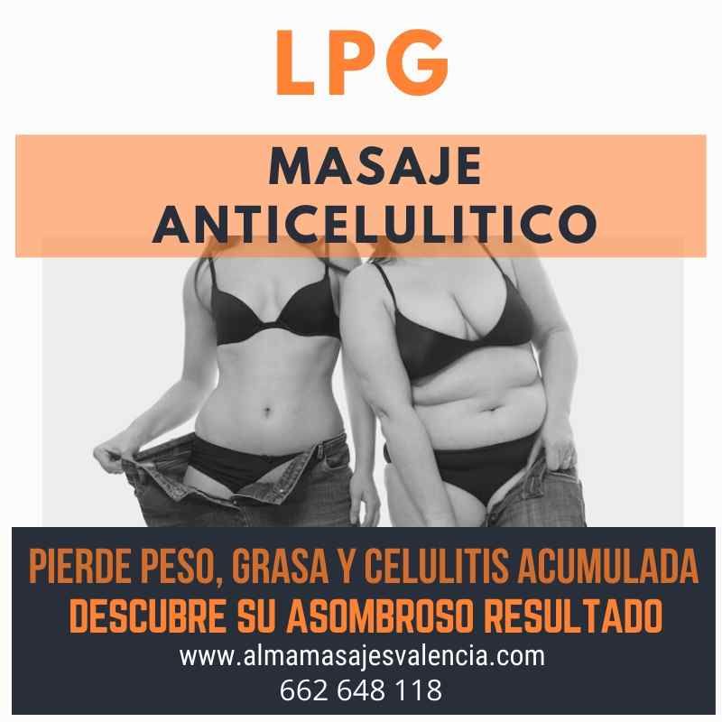 Masaje anticelulitico LPG para adelgazar